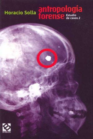 ANTROPOLOGIA FORENSE- ESTUDIO DE CASOS 2